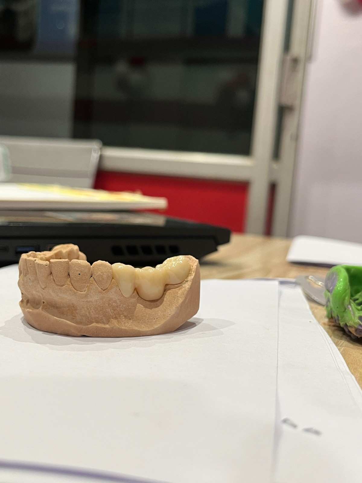 Smile Dental Clinic Treatment Room